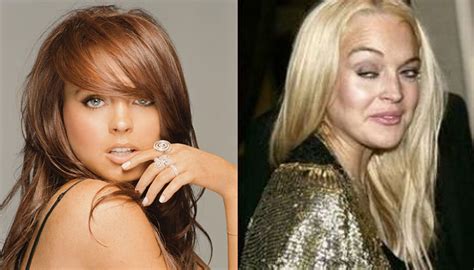 Top 10 Most Botched Celebrity Plastic Surgery Jobs | Celebrity plastic ...