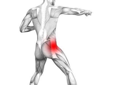 Piriformis Syndrome Signs & Symptoms | Treatment in Chicago, IL