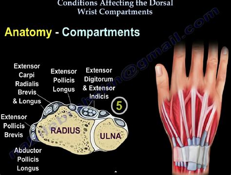 Dorsal Wrist Compartment Diseases — OrthopaedicPrinciples.com