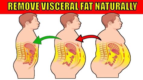 How to Get Rid of Visceral Fat Naturally - Epic Natural Health