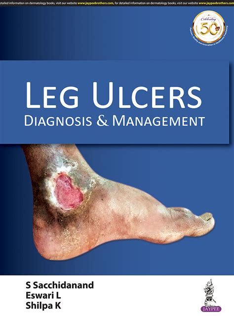 Leg Ulcers: Diagnosis And Management: Buy Leg Ulcers: Diagnosis And ...