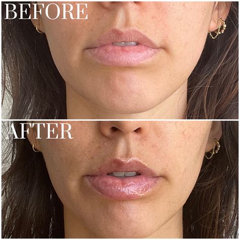 Rhode Peptide Lip Treatment Review With Photos | POPSUGAR Beauty UK