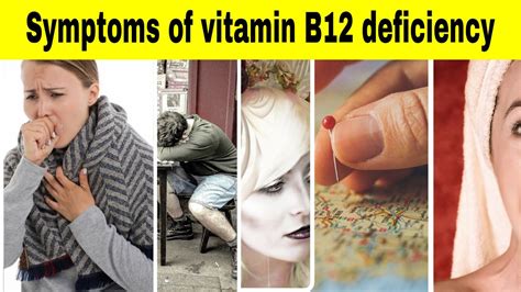 Symptoms of vitamin B12 deficiency - Vitamin Rush