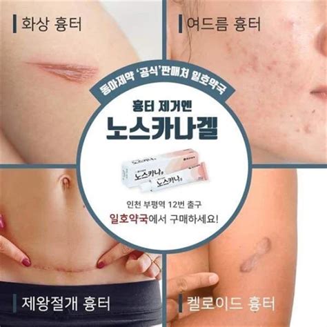 New Korea Noscana Gel Cream Dark Scar Noscana Gel 10g Surgery Scar ...