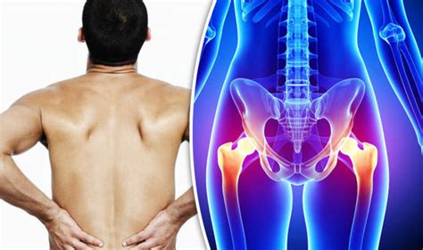 What is causing the pain in my hip and back? DR ROSEMARY answers your ...