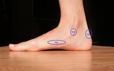 Heel Pain After Running? Here Are 10 Possible Causes + How To Fix It