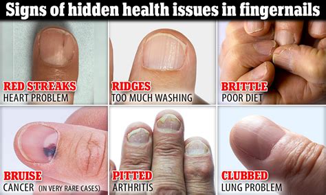 Healthy Fingernails