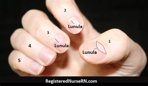 38+ Diagram Of Nail Structure - RuariDawood