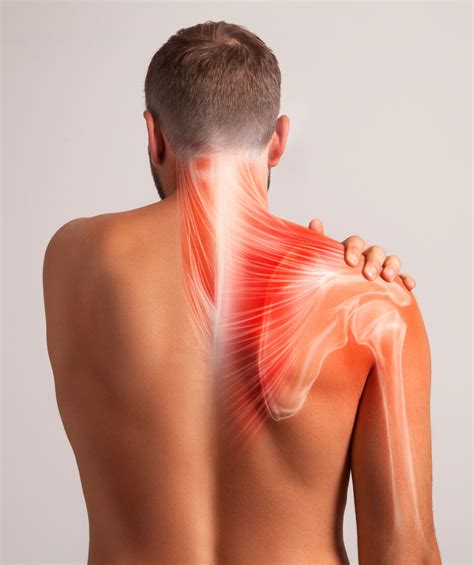 Neck and Shoulder Pain – Matrix Repatterning: Restoring Health From The ...