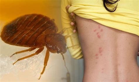 Bed bugs: Blood stains and shell casings are some of the main signs of ...