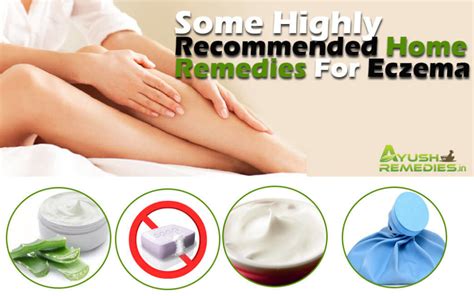 6 Home Remedies For Eczema, Highly Recommended Natural Treatments