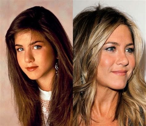 Jennifer Aniston Nose Job, Button Nose, Rhinoplasty, Friends Tv, Famous ...