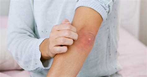 Pimple on Your Elbow: Main Causes and Treatments