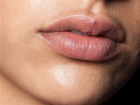 44 FAQs: Lip Shape Fillers: Benefits, Timeline, Risks, Process - Life ...