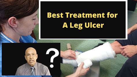 What is the Best Way to Heal a Leg Ulcer? | The VeinCare Centre