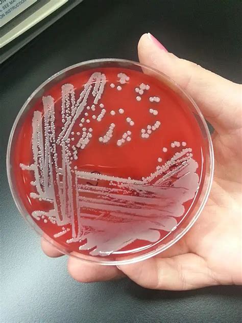 Staphylococcus Aureus Blood Agar Plate