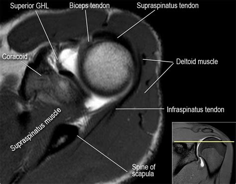 MRI Musculo-Skeletal Section: Axial view check list.