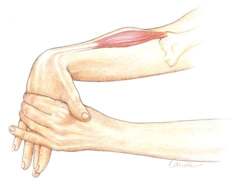 Tennis Elbow Exercises - Heal Fast and Strong | PhysioPrescription