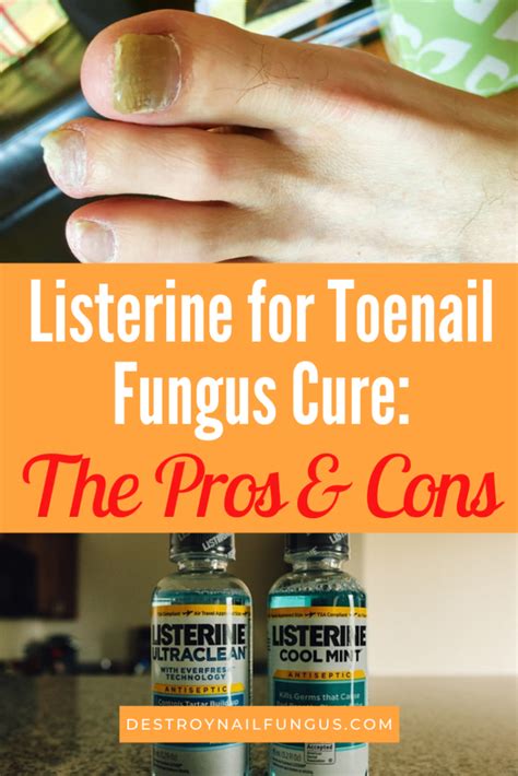 The Pros and Cons of Using Listerine to Cure Toenail Fungus