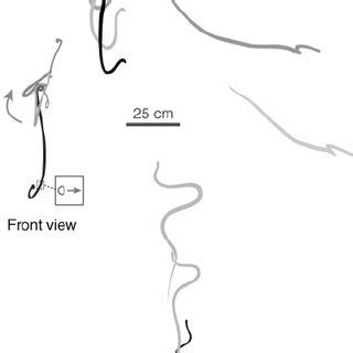 Rotation of the ribs in one form of dorsoventral flattening in ...