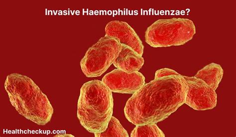 Invasive Haemophilus influenzae - Symptoms, Diagnosis, Treatment