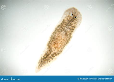 Planaria Flatworm Under Microscope View. Royalty-Free Stock Photo ...