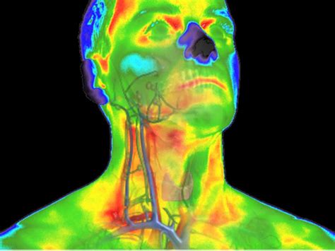 Yevette Sutter, RN Explains Thermography - Welcome to South County ...