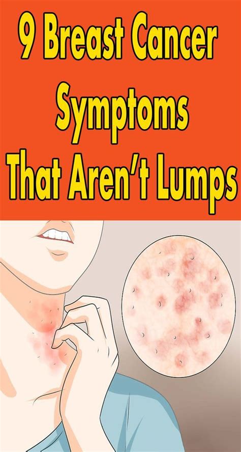 9 Breast Cancer Symptoms That Aren’t Lumps - Sweet Oh Joy