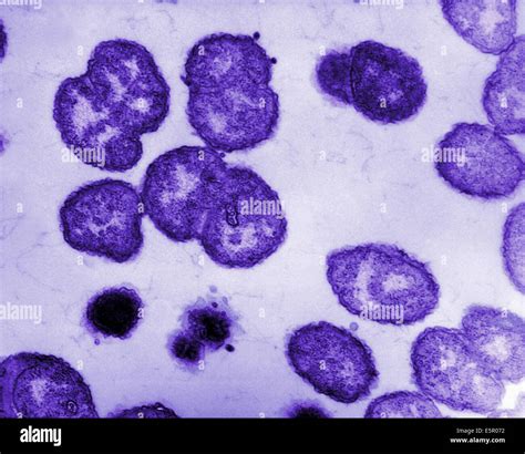 Neisseria Gonorrhoeae Gram Stain 1000X