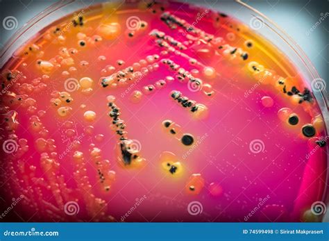 Bacterial Colonies Culture on Selective Agar Media(SS Agar). Stock ...