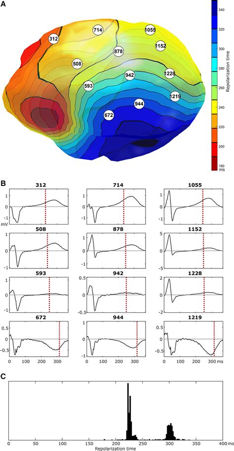 Epicardial isochrones of repolarization times [panel (A)] and selected ...