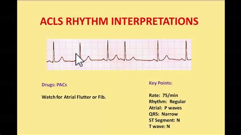 ACLS EKG Rhythms 2016 - Interpretations and managements by NIK NIKAM MD ...