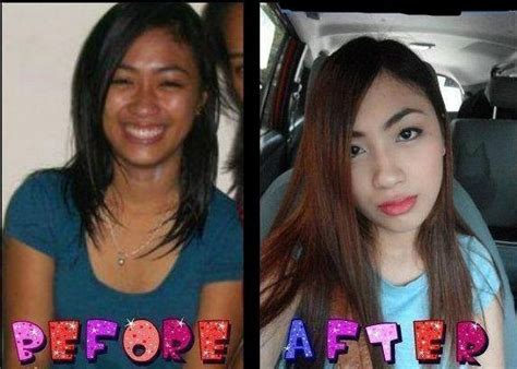 Glutathione skin lightening before and after