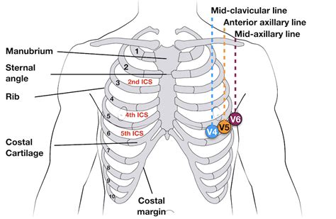 ECG Lead positioning • LITFL • ECG Library Basics