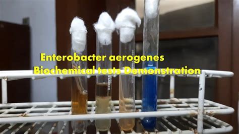 Enterobacter aerogenes Biochemical tests Demonstration