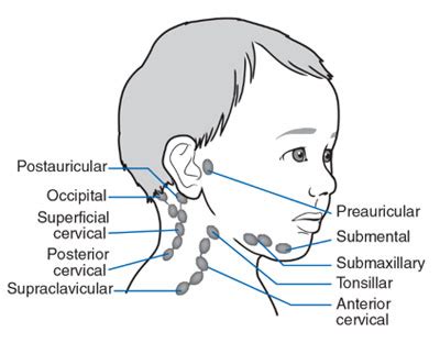 Painful lymph nodes - ascsefactor