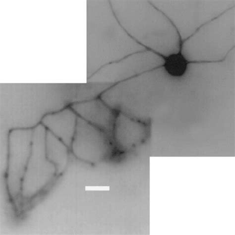 Basket cell morphology. Basket cell identity was confirmed by ...