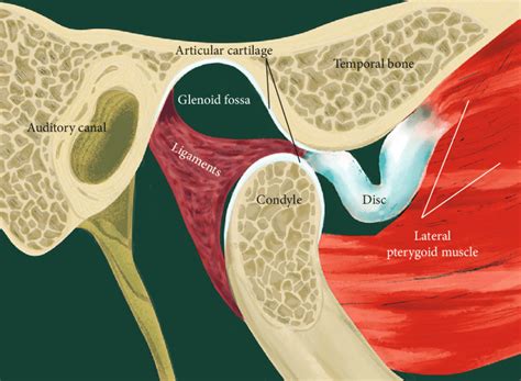 Temporomandibular Joint Disc