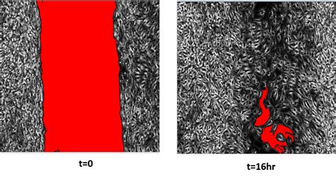 Imaging and Analyzing Your Wound Healing Assay