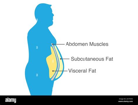 Visceral fat and subcutaneous fat that accumulate around your waistline ...