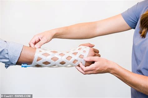 The end of the plaster cast? Start-up creates a waterproof and mesh ...