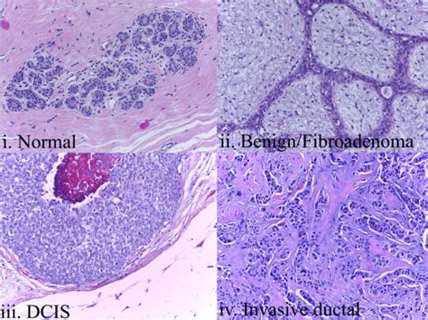 Representative images of the 4 breast tissue histology classes ...