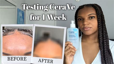 Cerave Renewing Sa Cleanser Before And After - Cerave Renewing Sa ...