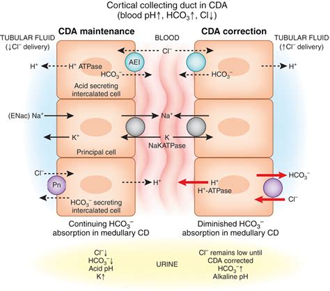 Figure 1 from It is chloride depletion alkalosis, not contraction ...