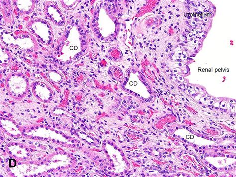 Collecting Ducts Kidney Histology