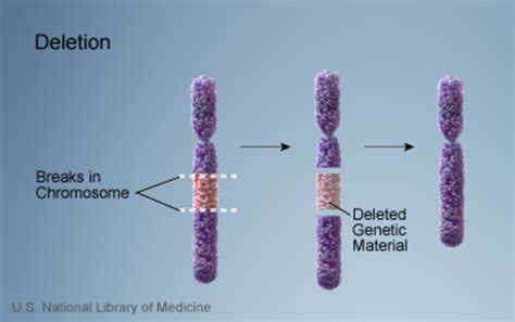 Williams syndrome: MedlinePlus Genetics