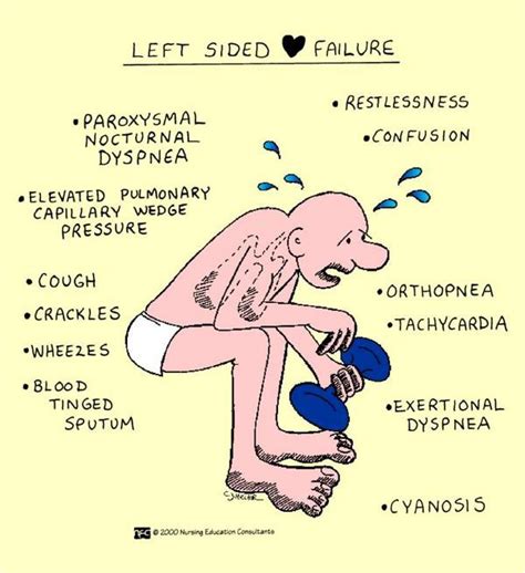 Left-sided heart failure occurs when the left ventricle is not pumping ...