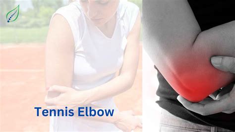 Tennis elbow | Best Back Pain, Slip Disc, Knee Arthritis, Sciatica ...