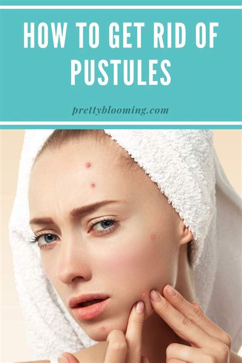 Have you suffered long enough from Pustules? If you experience acne in ...