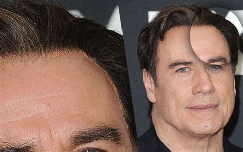 Must-See Photos — Is That The Glue Holding John Travolta's Hair In Place?